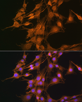 ELOVL4 antibody