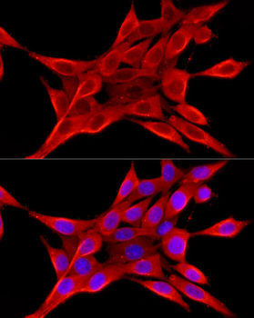 ELOVL4 antibody