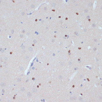 ESRRA antibody