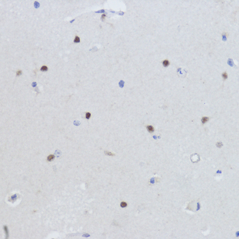 ESRRA antibody