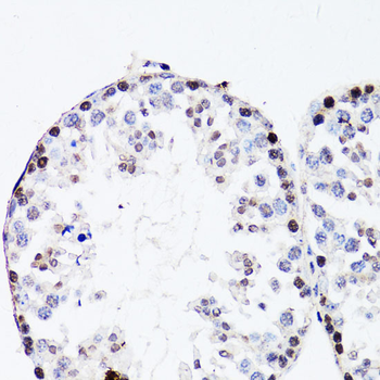 FGF12 antibody