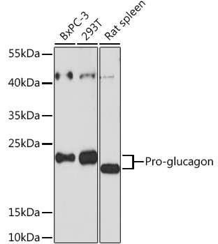 GLP1 antibody