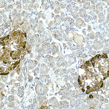 GLP1 antibody