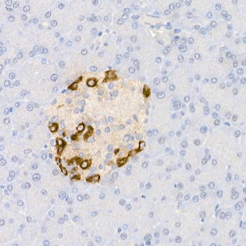 GLP1 antibody