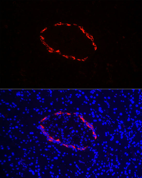 GLP1 antibody