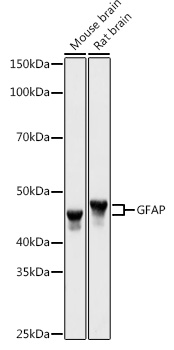 GFAP antibody