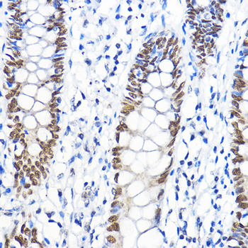 GTF2B antibody