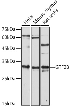 GTF2B antibody