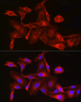 HMGCR antibody