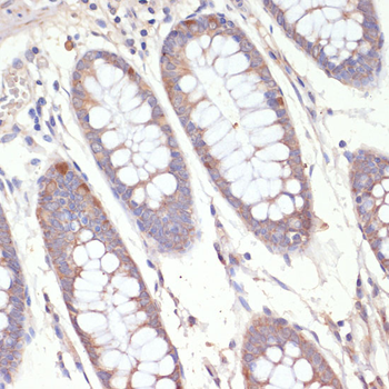 HMGCR antibody