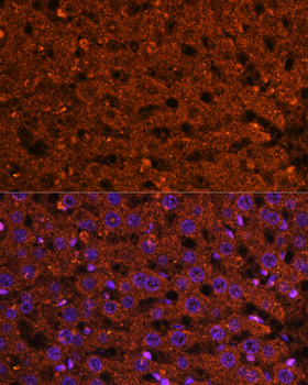 HMGCS2 antibody