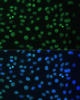 HNRNPD antibody