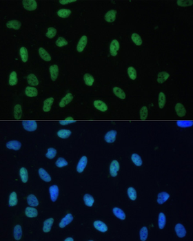 HNRNPD antibody