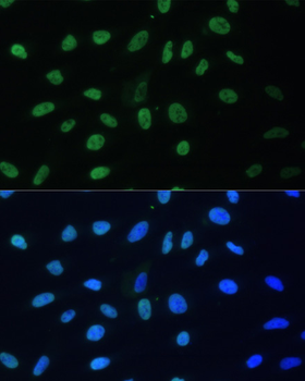 HNRNPD antibody