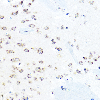 HSP90B1 antibody