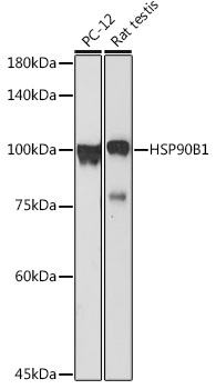 HSP90B1 antibody