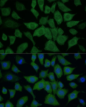 IDH1 antibody