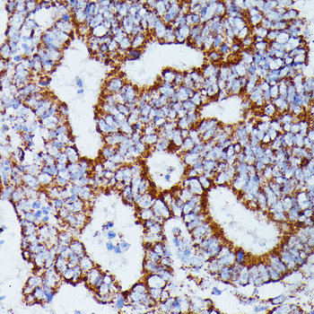 IDH3A antibody