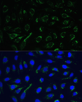 IDH3A antibody