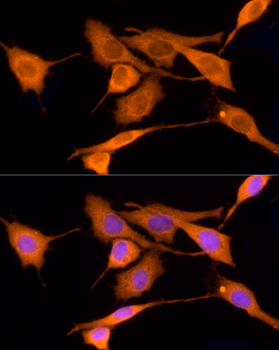 Iduronate 2 sulfatase antibody