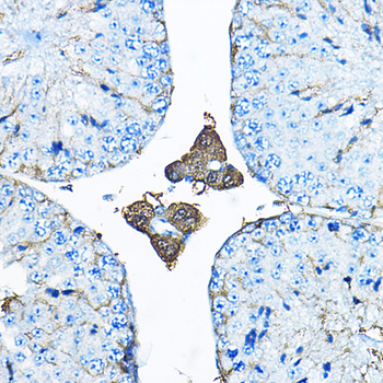 Iduronate 2 sulfatase antibody