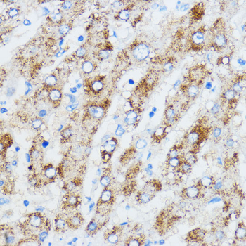 IGF2BP3 antibody