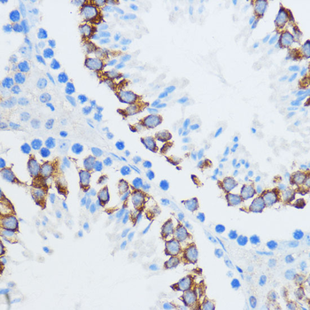 IGF2BP3 antibody