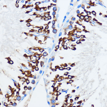 IGF2BP3 antibody