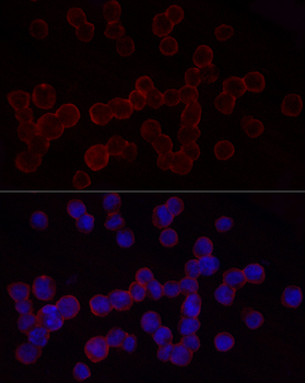 ITGB2 antibody