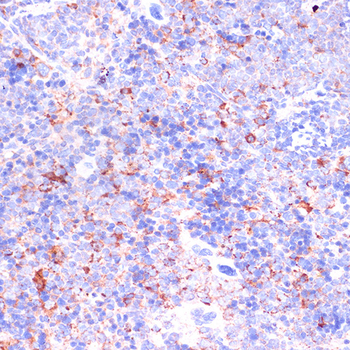 ITGB2 antibody