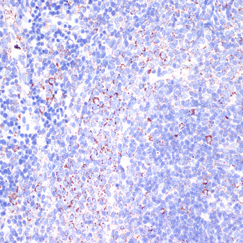 ITGB2 antibody