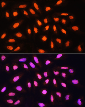 KAT2A antibody