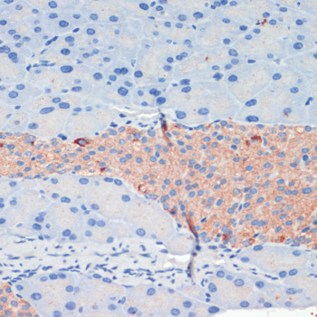 KIF5B antibody