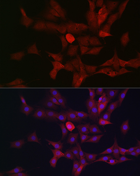 c-Kit antibody