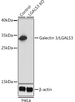 Galectin 3 antibody