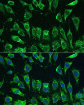 Galectin 3 antibody