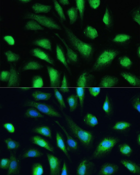 Galectin 3 antibody