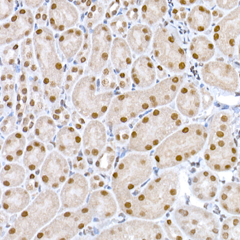 LIG3 antibody