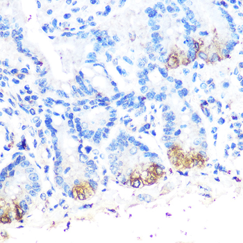 Lysozyme antibody