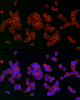 Lysozyme antibody