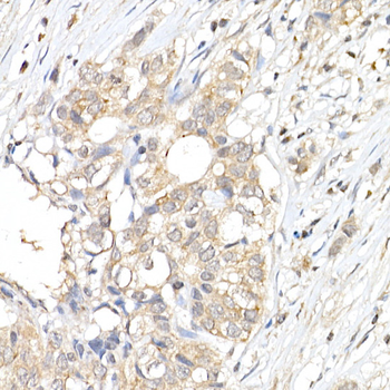 MAPK1/MAPK3 antibody