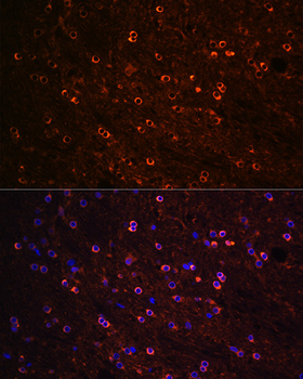 Tau antibody