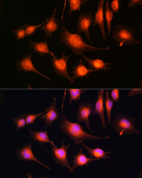 Tau antibody