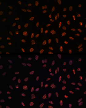 MATR3 antibody