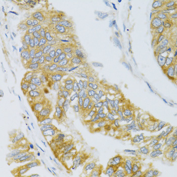 MBL2 antibody