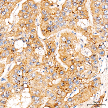 MBTPS1 antibody