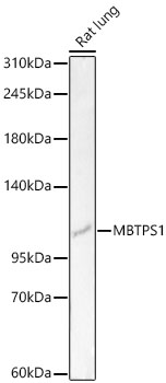 MBTPS1 antibody