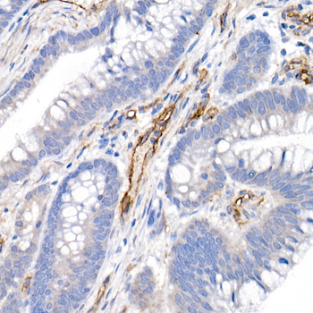 CD146 antibody