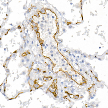 CD146 antibody