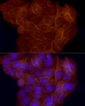 CD146 antibody